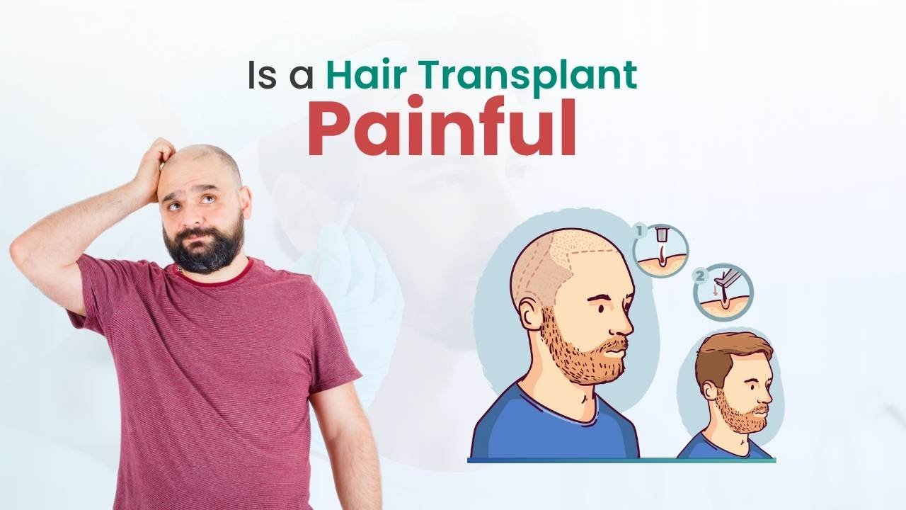 Is a Hair Transplant Painful