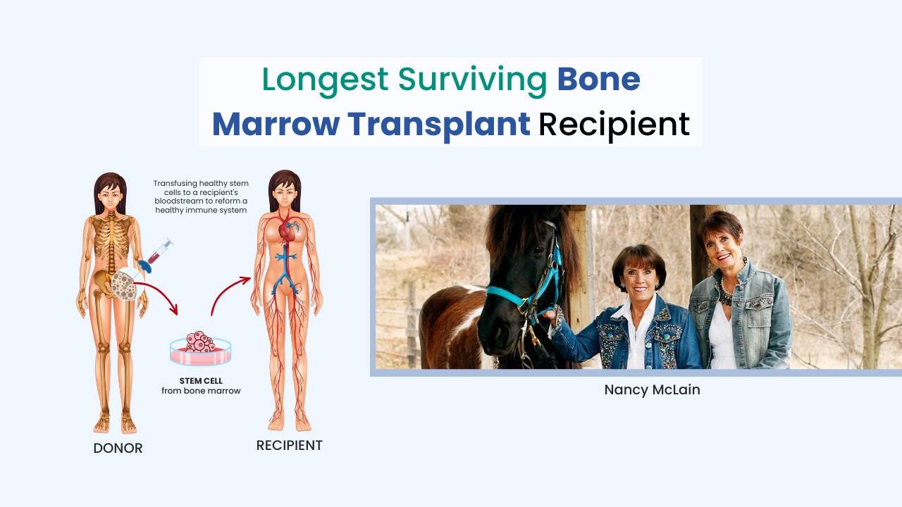 Longest Surviving Bone Marrow Transplant Recipient