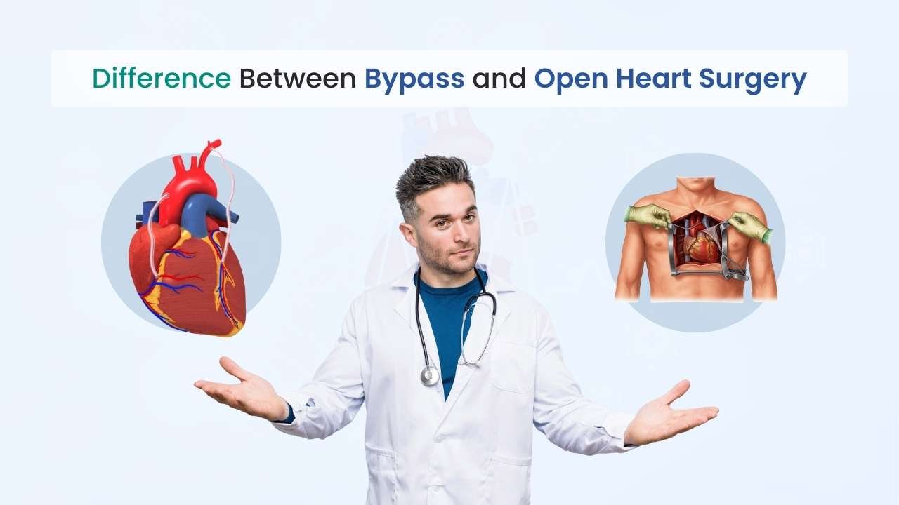 Understanding the Difference Between Bypass and Open Heart Surgery