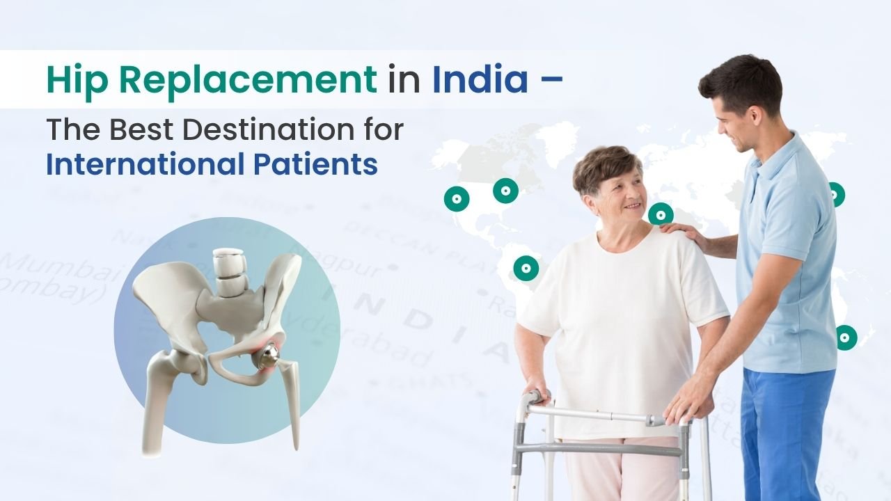 Hip Replacement in India – best country for hip replacement abroad