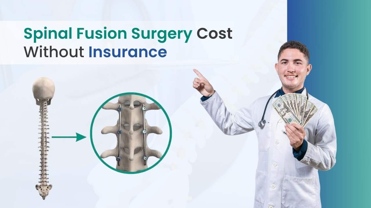 Spinal Fusion Surgery Cost Without Insurance