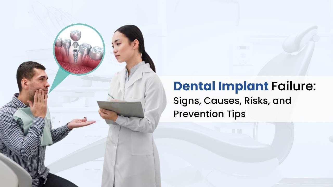 Dental Implant Failure: Signs, Causes, Risks, and Prevention Tips