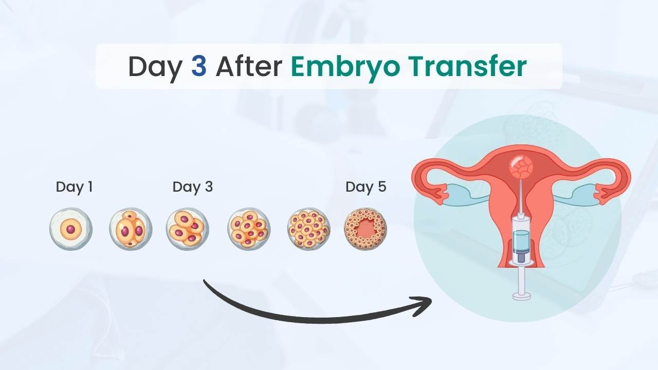 Day 3 After Embryo Transfer