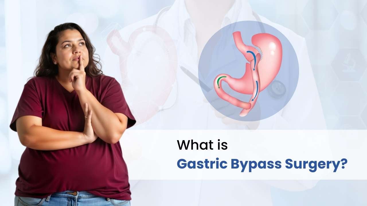 Bariatric Surgery Scars(Gastric Bypass Scars): What to expect and How to Fade them