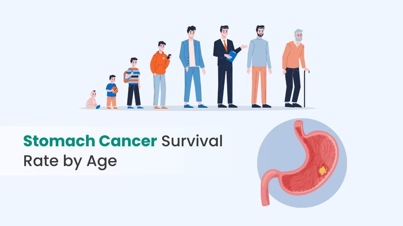 Stomach Cancer Survival Rate by Age