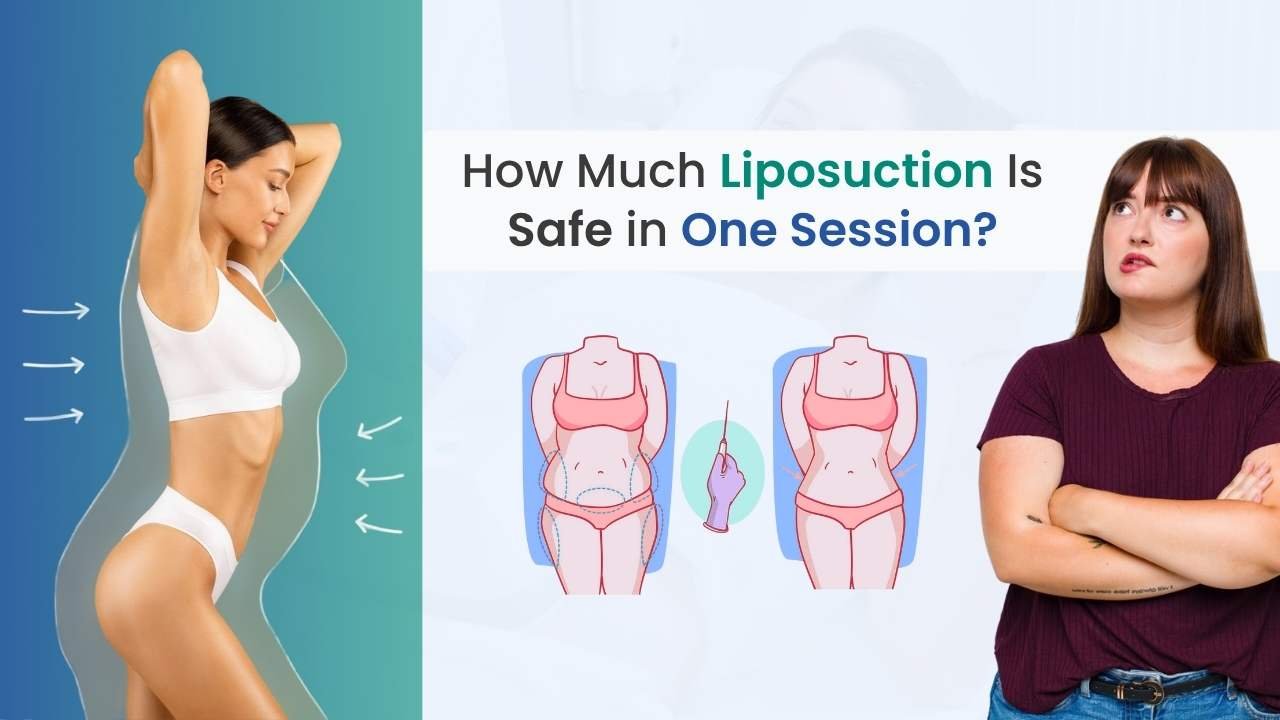 How Much Liposuction Is Safe in One Session?