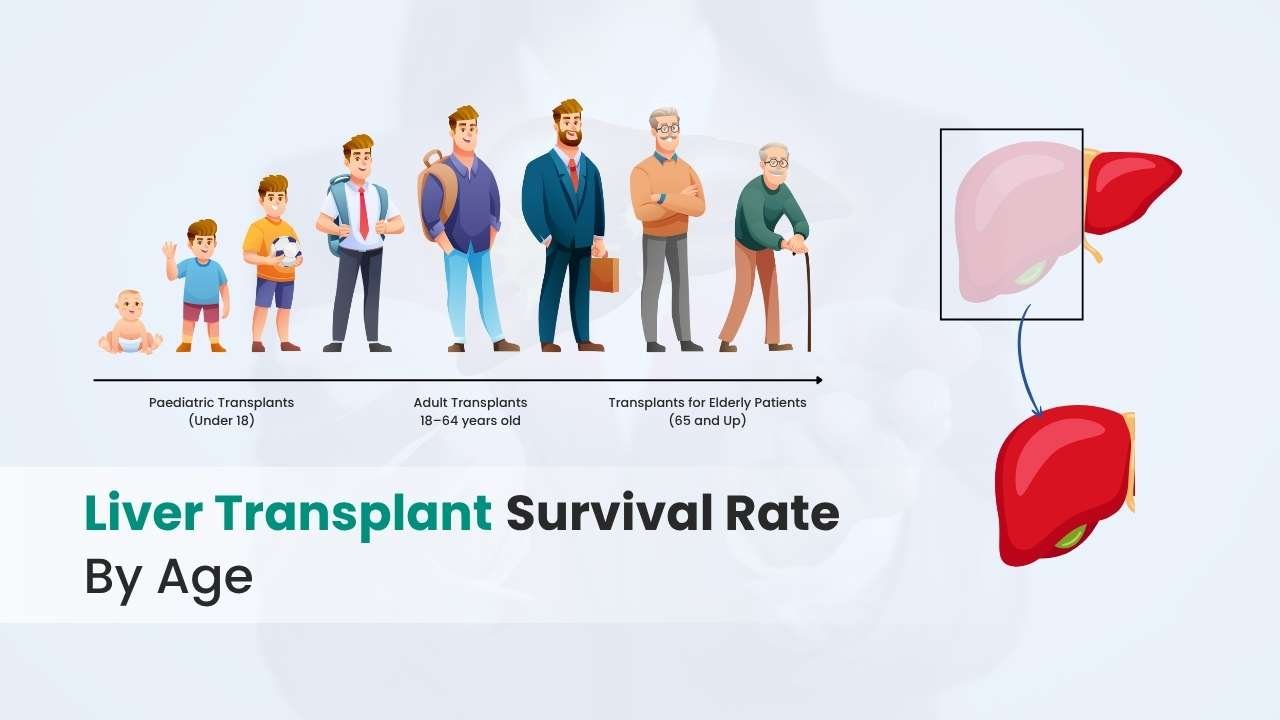 Liver Transplant Survival Rate By Age