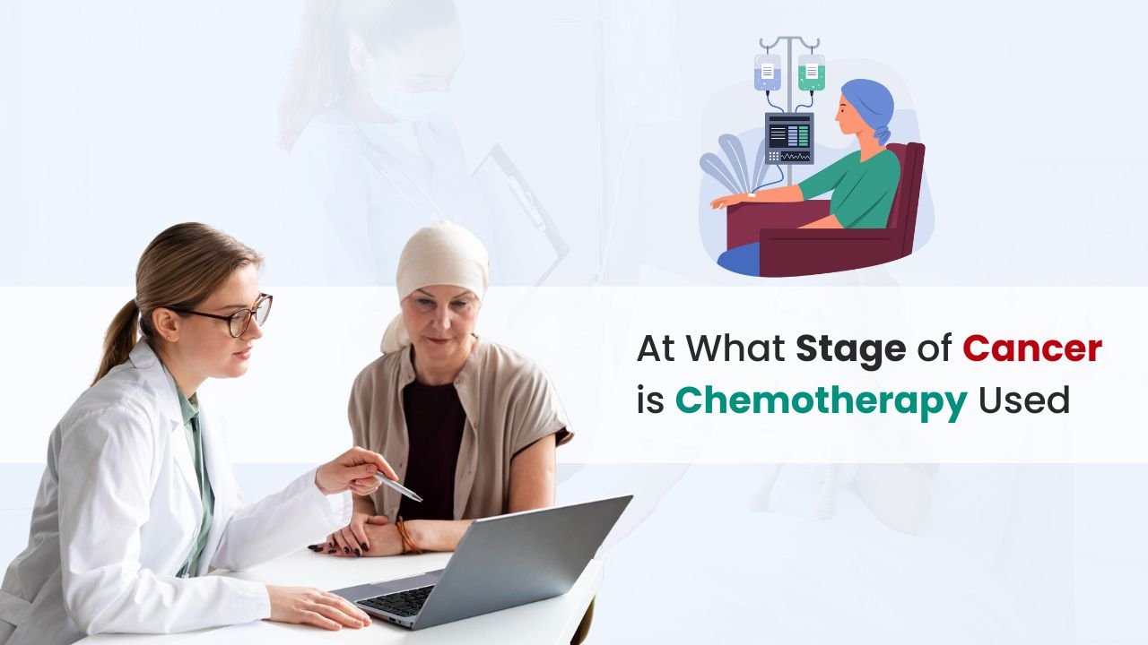 At What Stage of Cancer is Chemotherapy Used